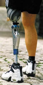 Рис. 16. Благодаря европейской программе CUSTOM-FIT протезы позволяют людям с ограниченными физическими возможностями вести активный