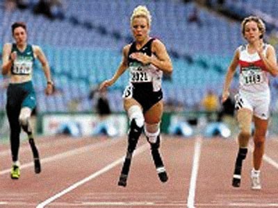 Рис. 16. Благодаря европейской программе CUSTOM-FIT протезы позволяют людям с ограниченными физическими возможностями вести активный