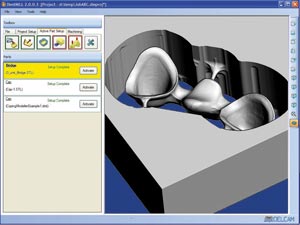 Рис. 27. Система DentMILL позволяет автоматизировать процесс протезирования