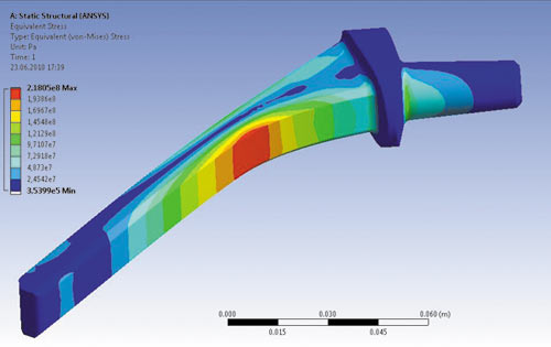 Рис. 7. Анализ НДС эндопротеза тазобедренного сустава: