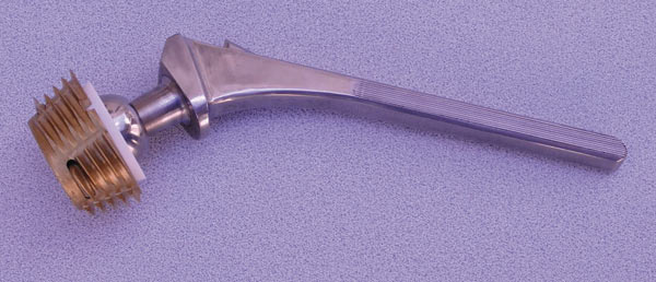 Рис. 12. Эндопротез тазобедренного сустава в сборе